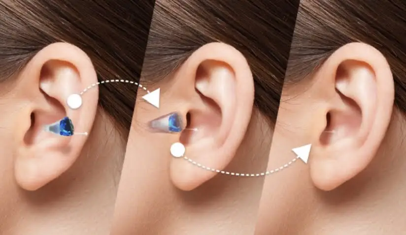 Senior enjoying clear conversation with discreet hearing aid